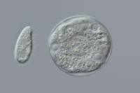 Amibe (Arcella ) et petit protozoaire x160